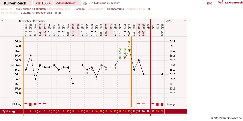 NFP-Kurve User #24156