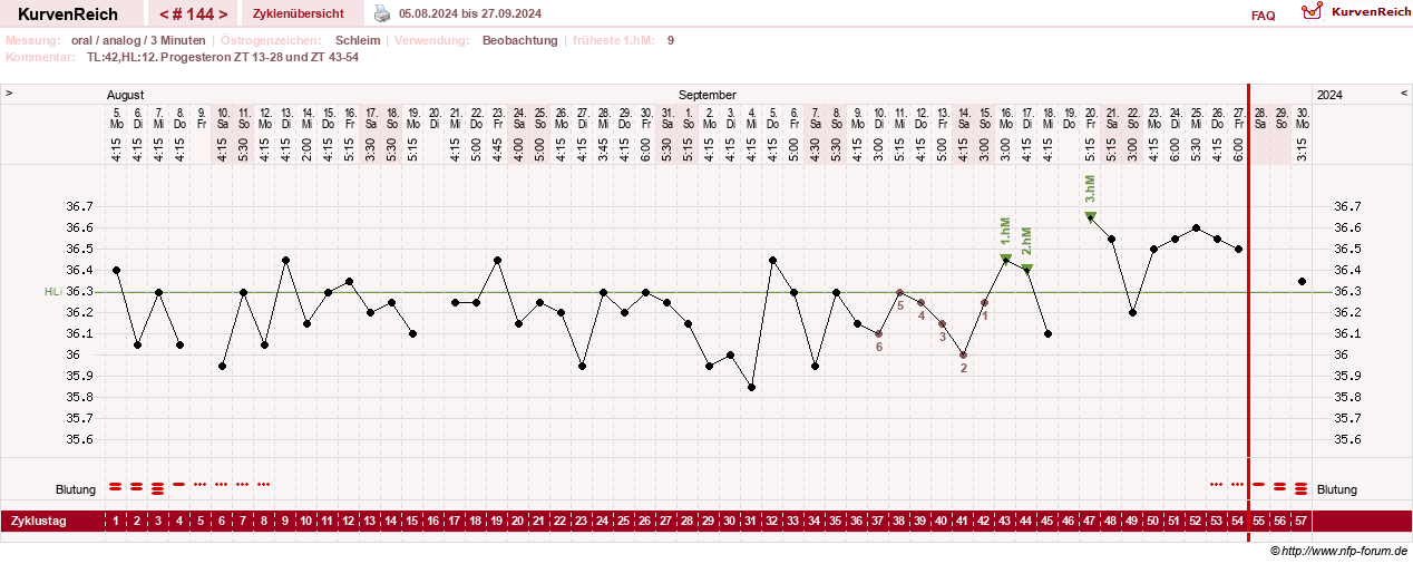 NFP-Kurve User #24156