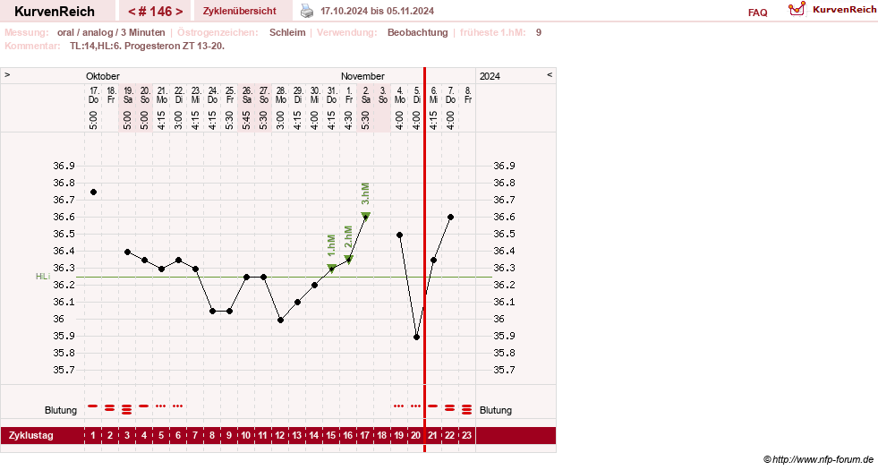 NFP-Kurve User #24156