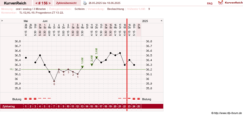 NFP-Kurve User #24156