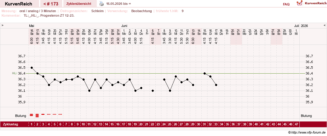 NFP-Kurve User #24156