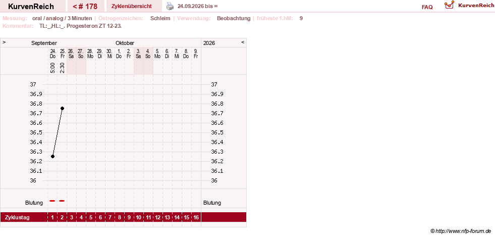 NFP-Kurve User #24156