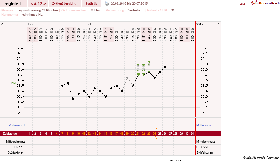 NFP-Kurve User #24292