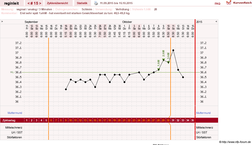 NFP-Kurve User #24292