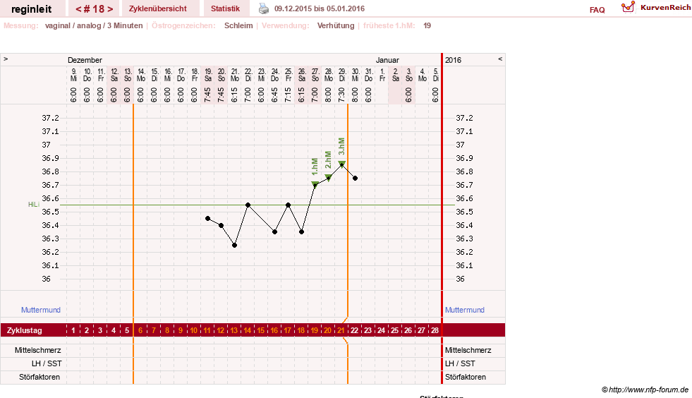 NFP-Kurve User #24292