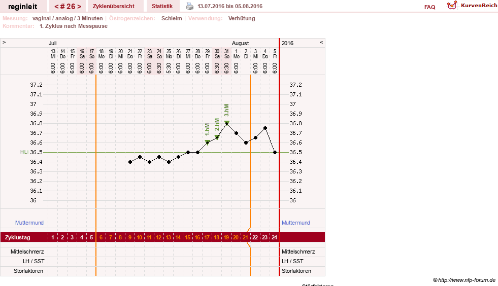 NFP-Kurve User #24292