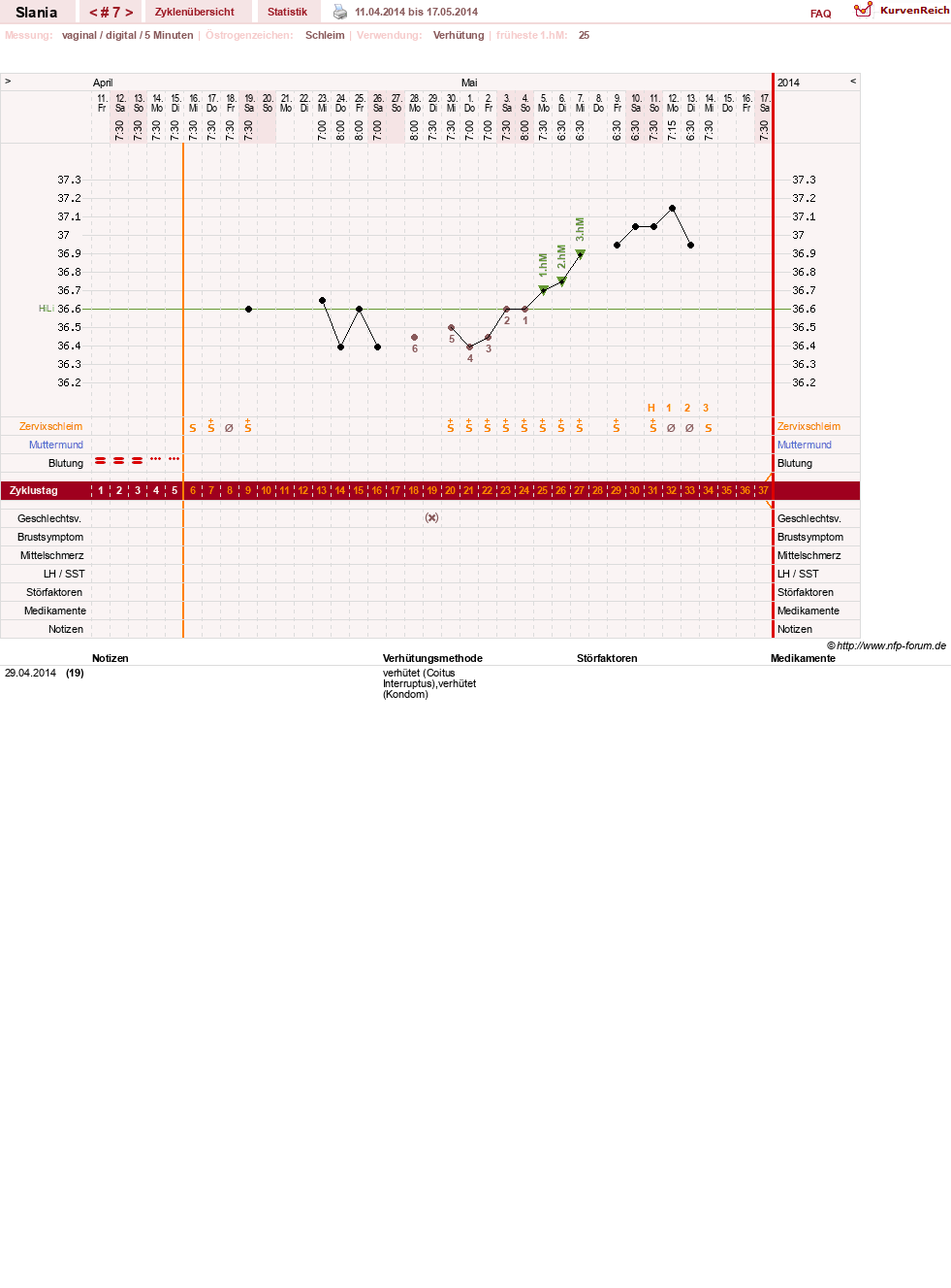NFP-Kurve User #24356