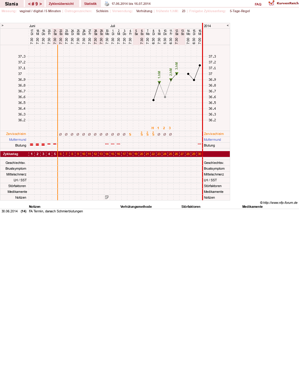 NFP-Kurve User #24356