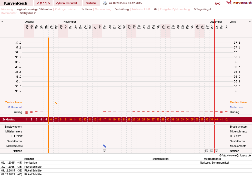 NFP-Kurve User #24387