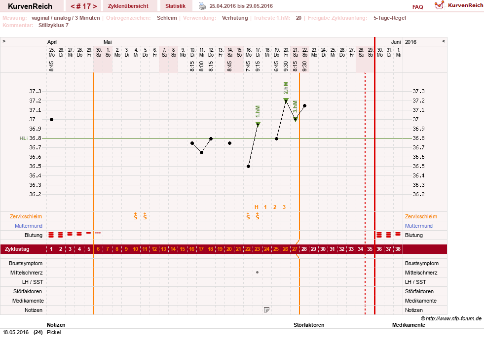 NFP-Kurve User #24387