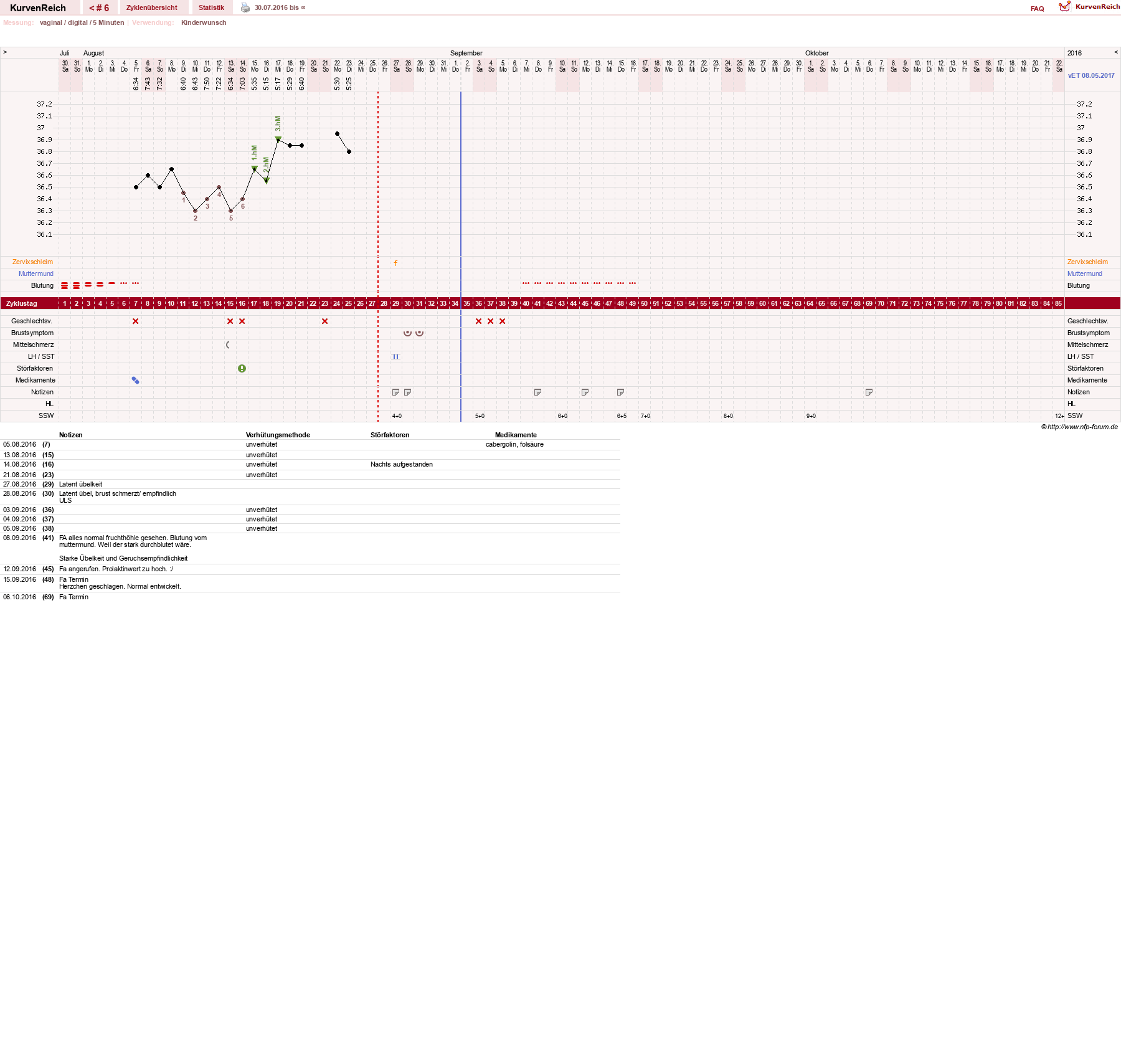 NFP-Kurve User #24433