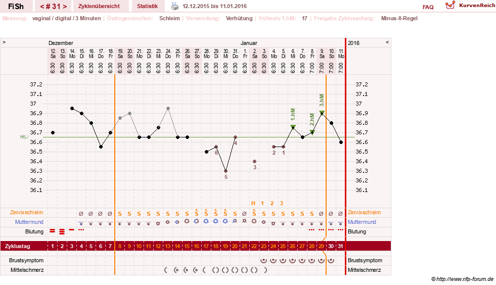 NFP-Kurve User #24456
