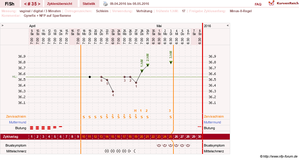 NFP-Kurve User #24456