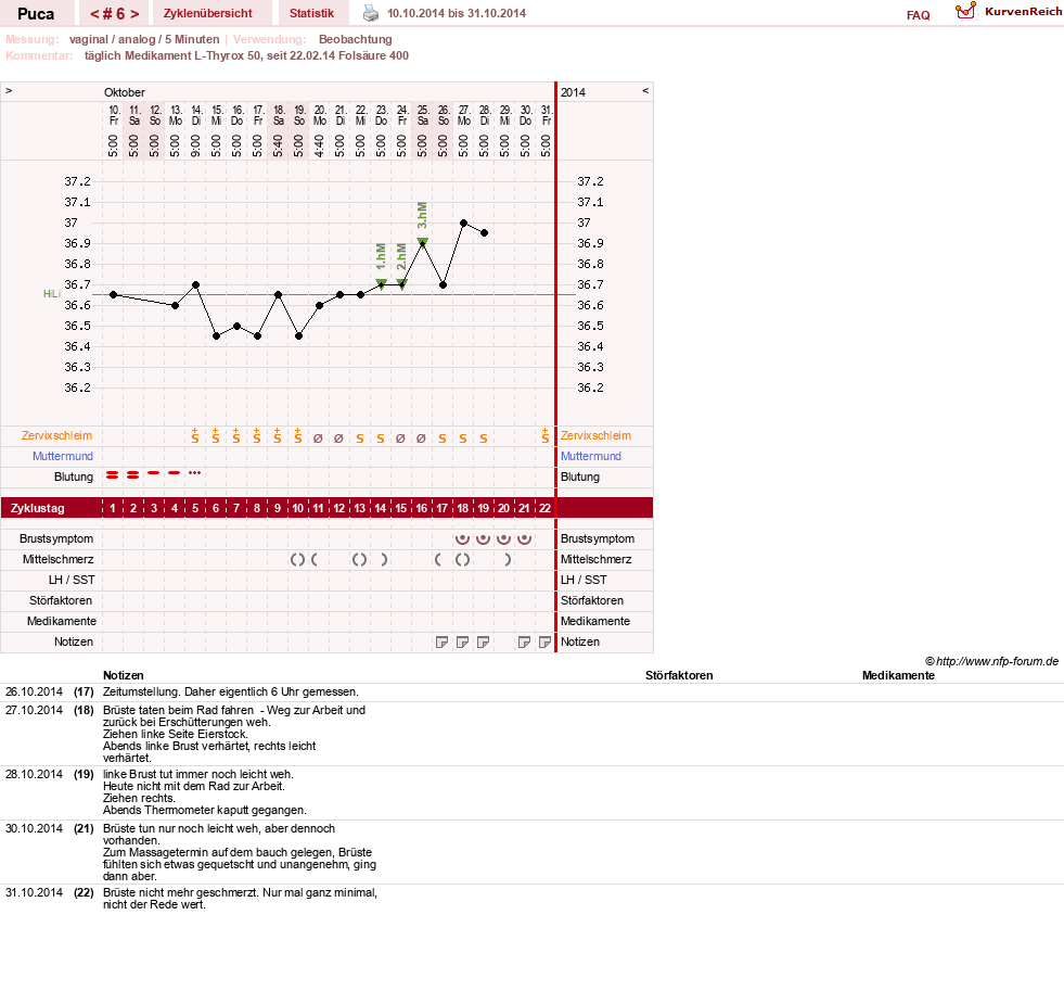 NFP-Kurve User #24619