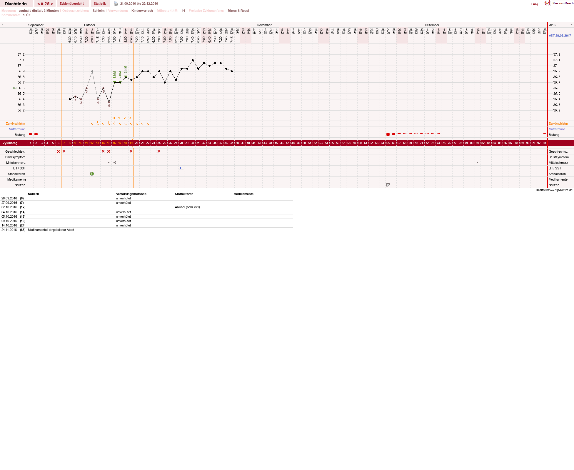 NFP-Kurve User #24824