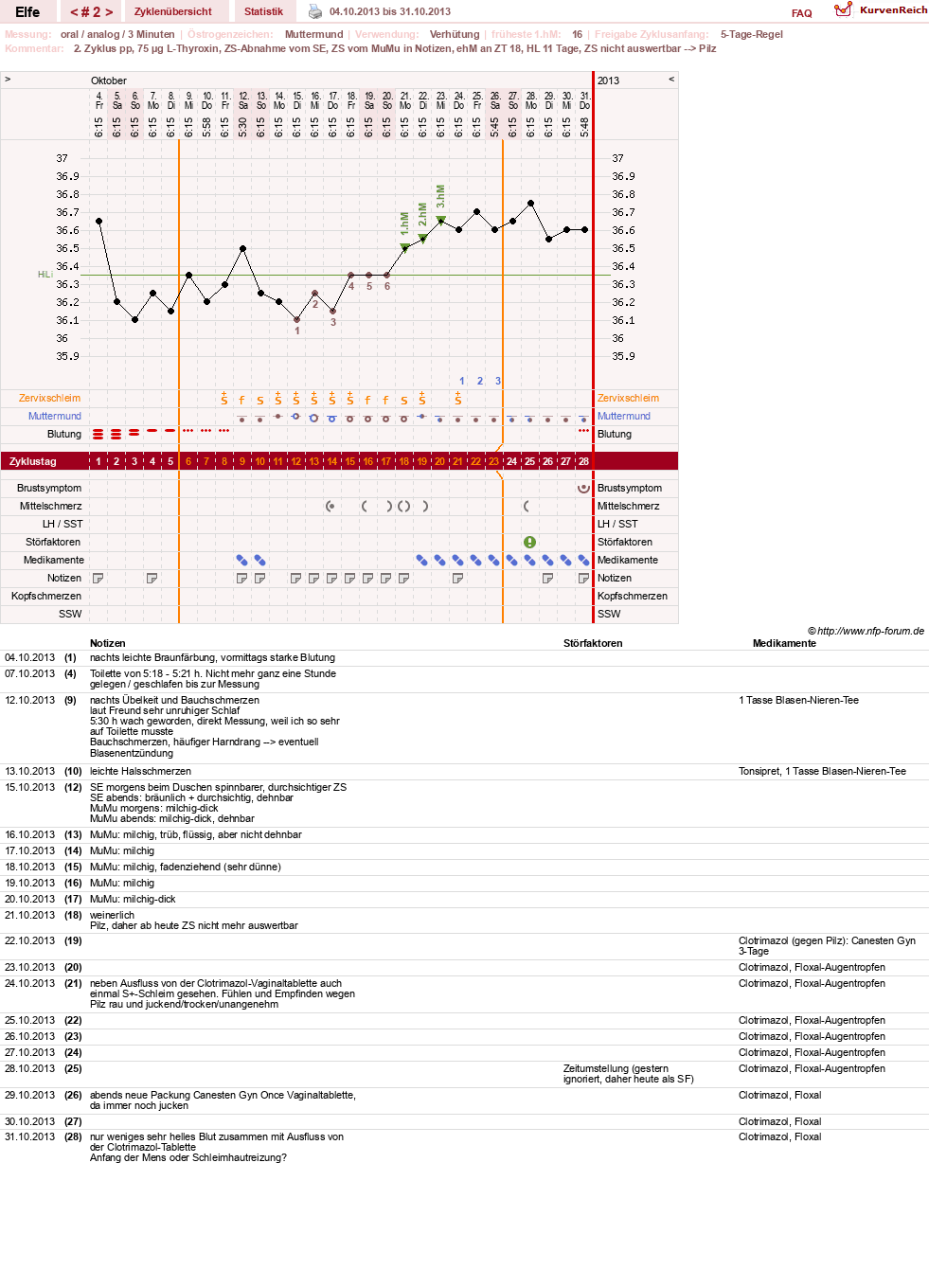 NFP-Kurve User #24928