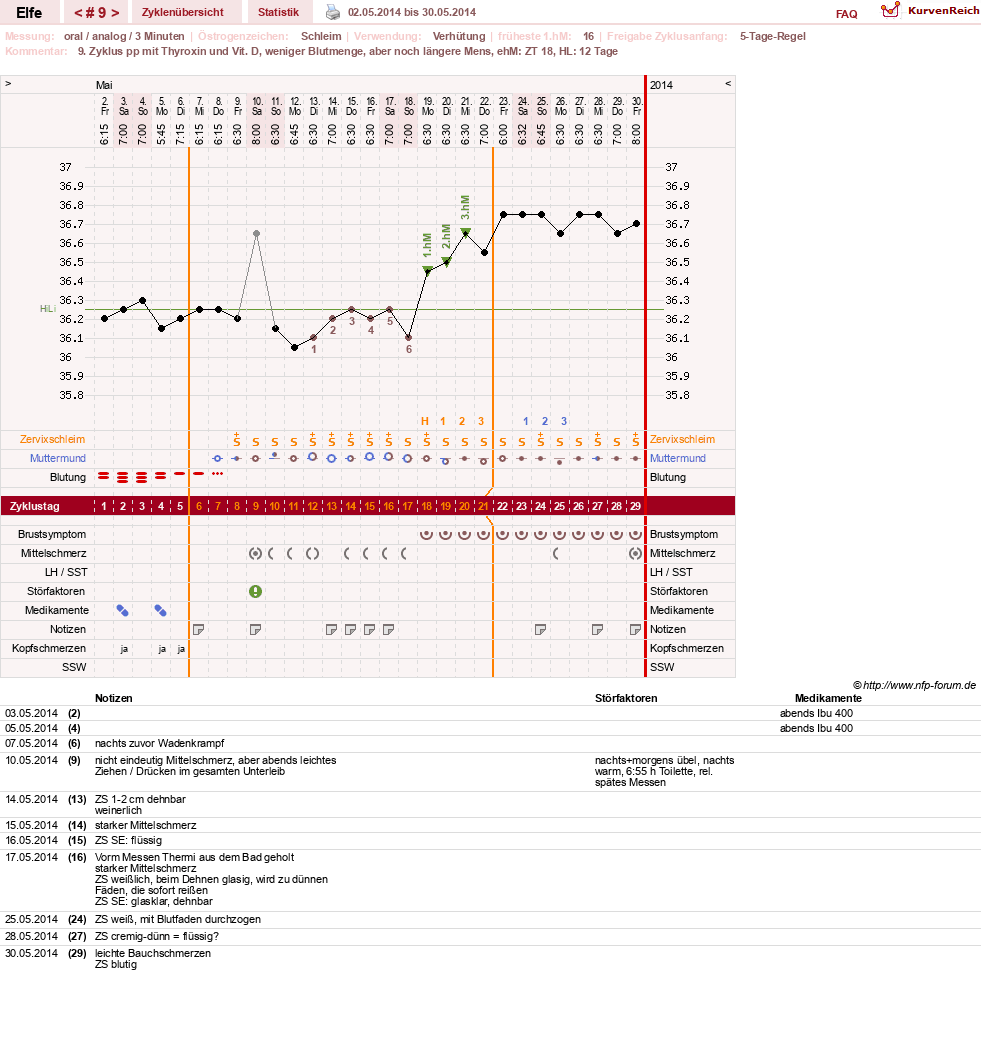NFP-Kurve User #24928