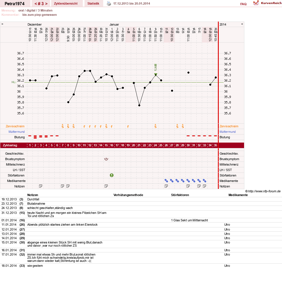 NFP-Kurve User #24929