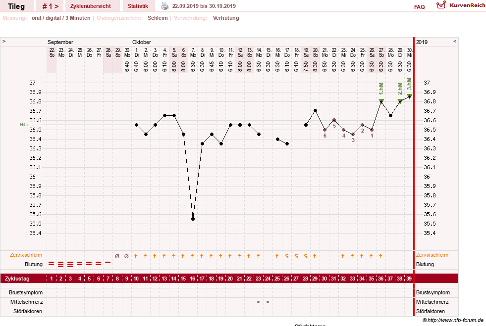 NFP-Kurve User #24965