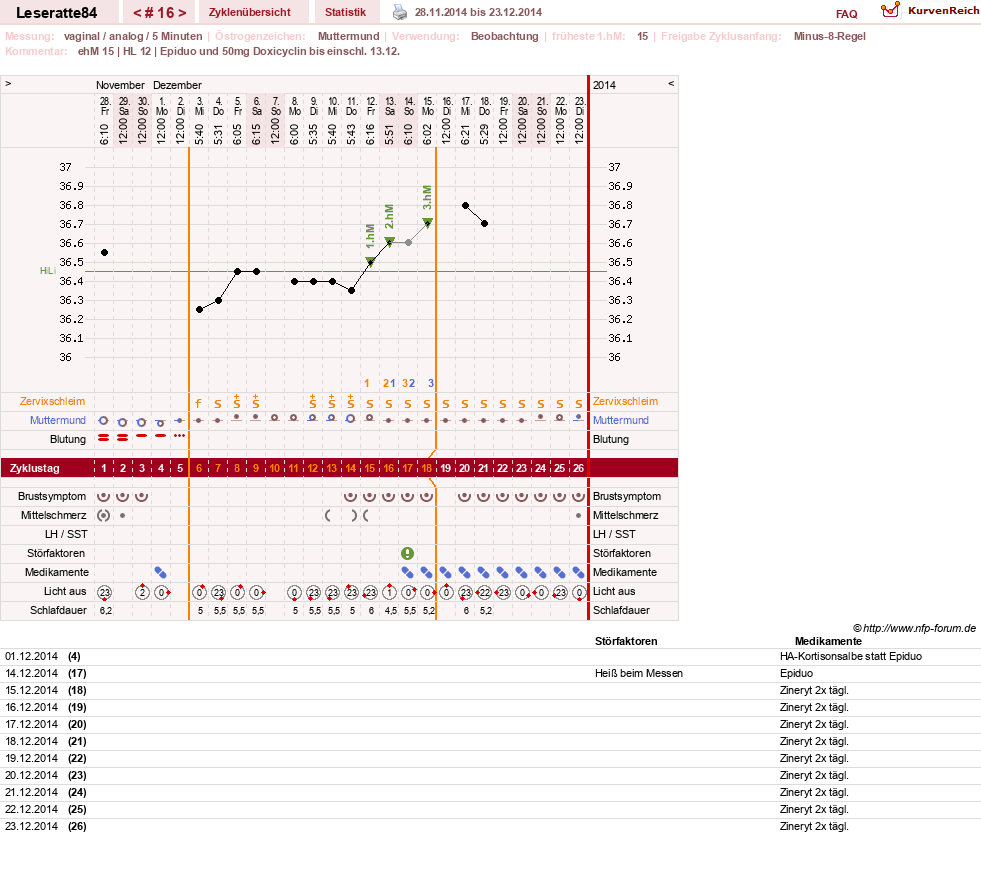 NFP-Kurve User #24968