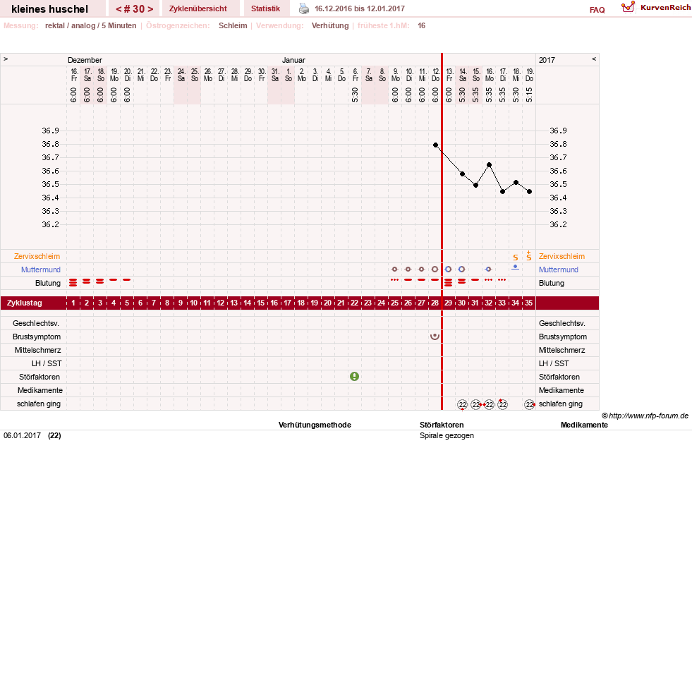NFP-Kurve User #25120