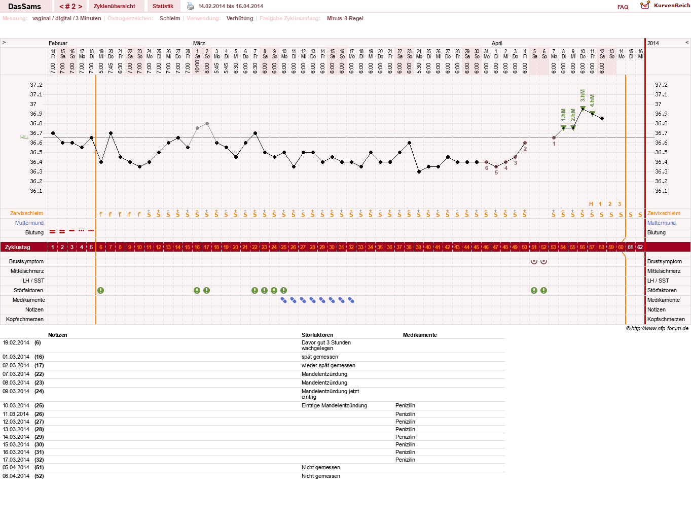NFP-Kurve User #25489