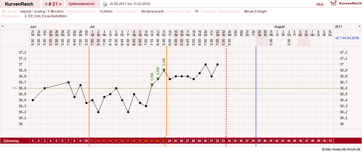 NFP-Kurve User #25492