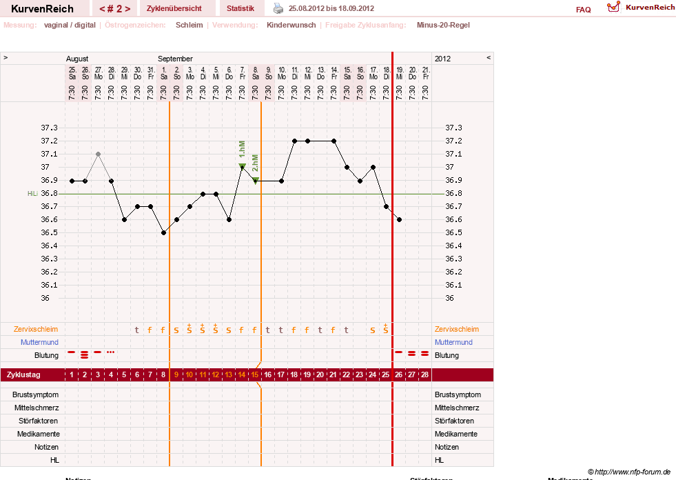 NFP-Kurve User #25583