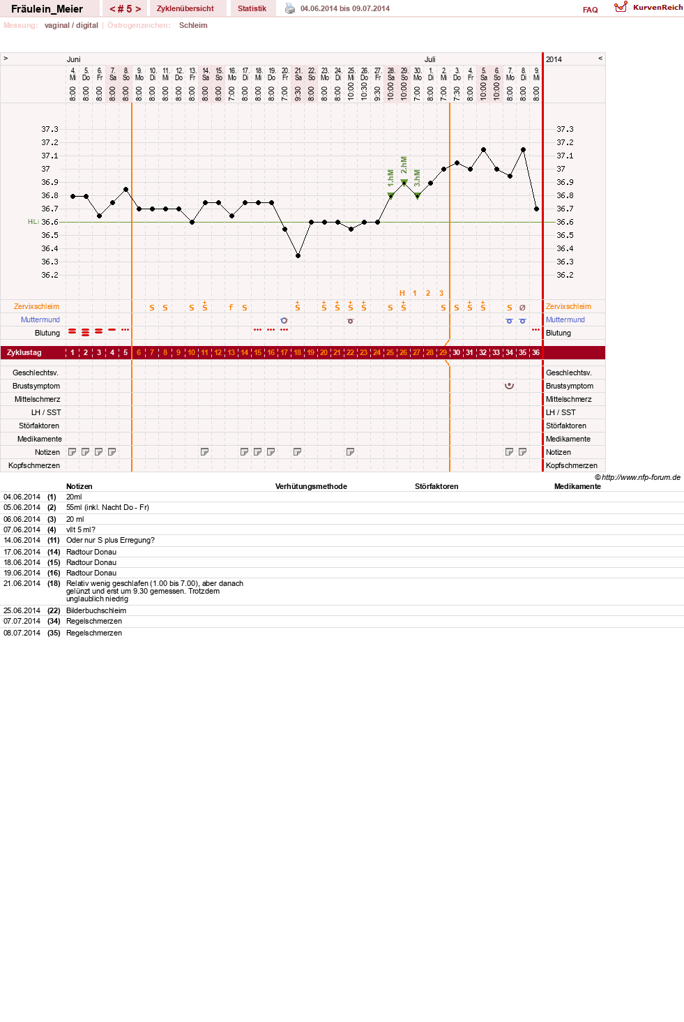 NFP-Kurve User #25664