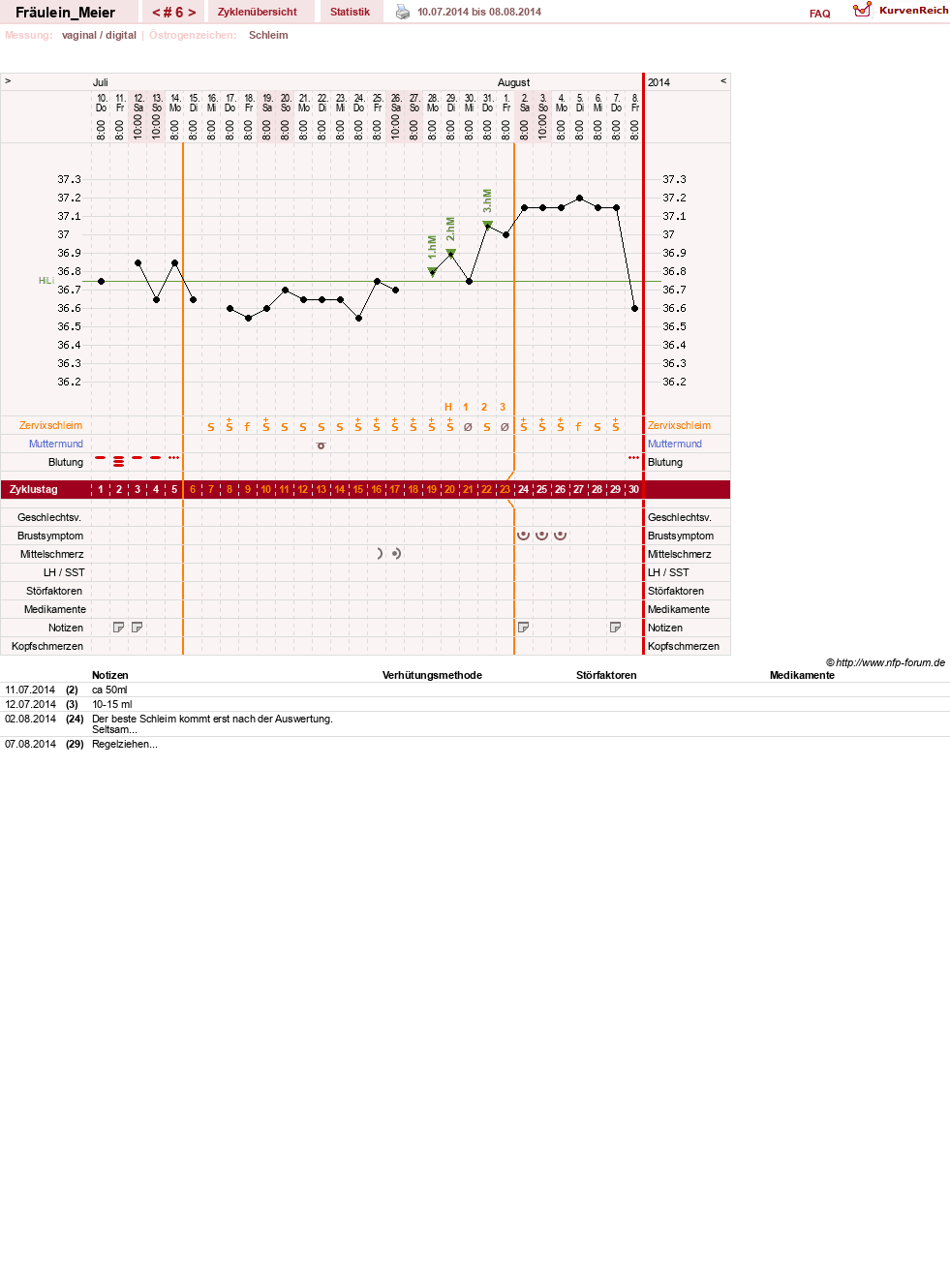 NFP-Kurve User #25664
