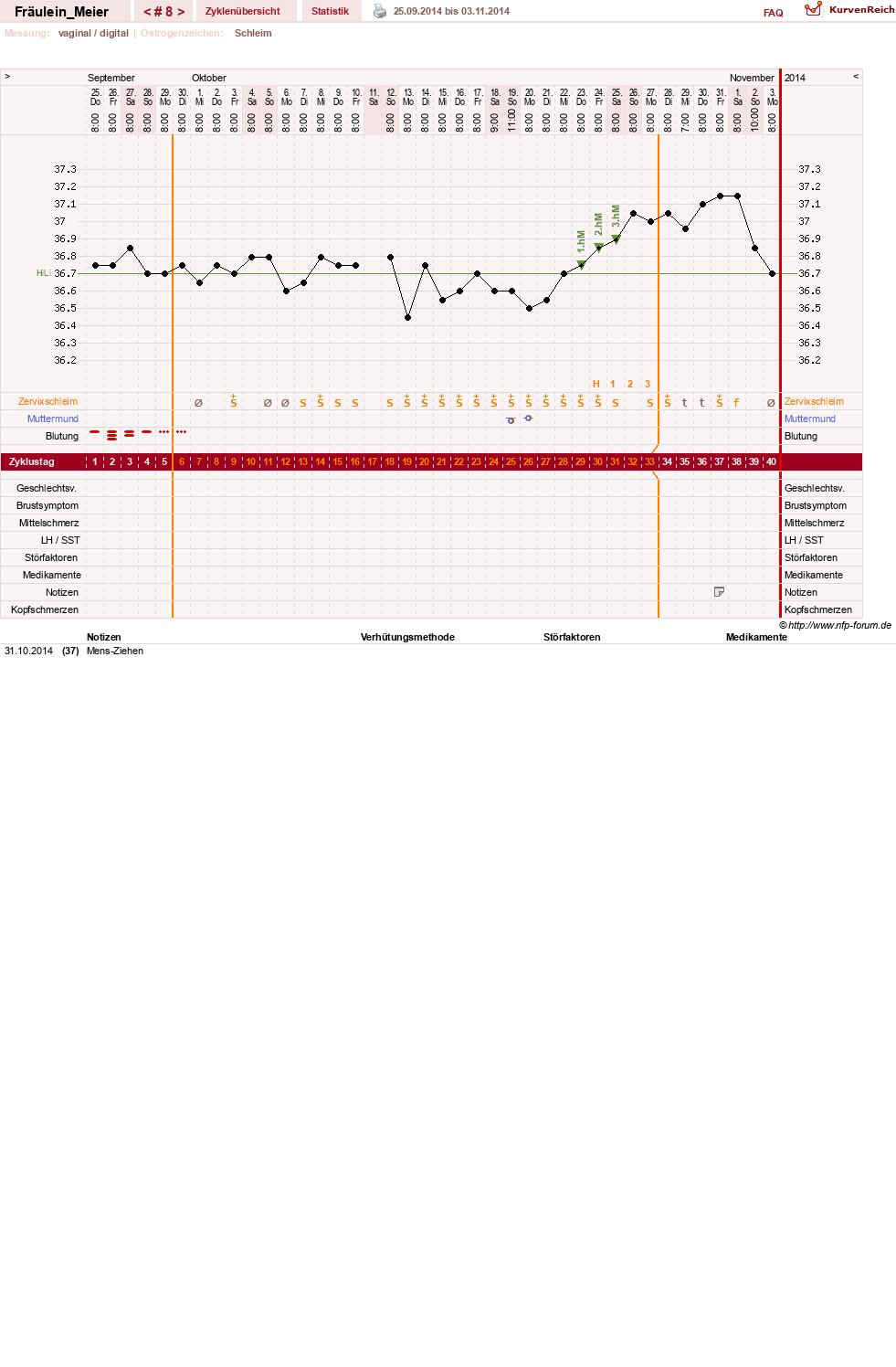 NFP-Kurve User #25664