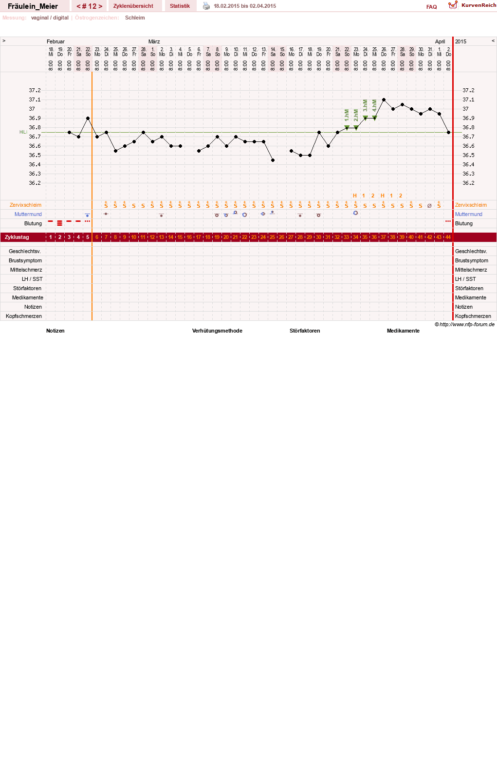 NFP-Kurve User #25664