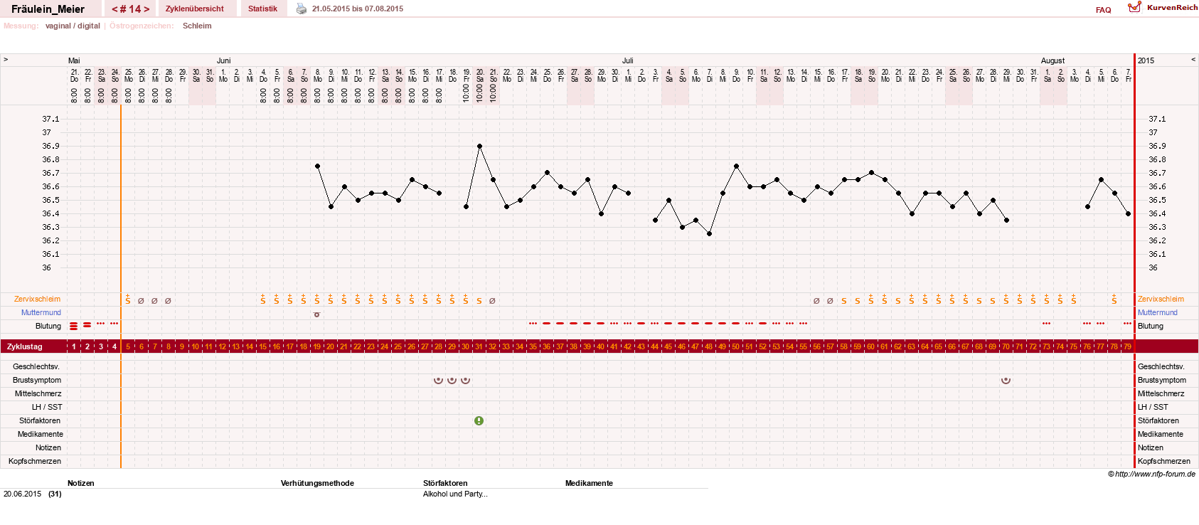 NFP-Kurve User #25664