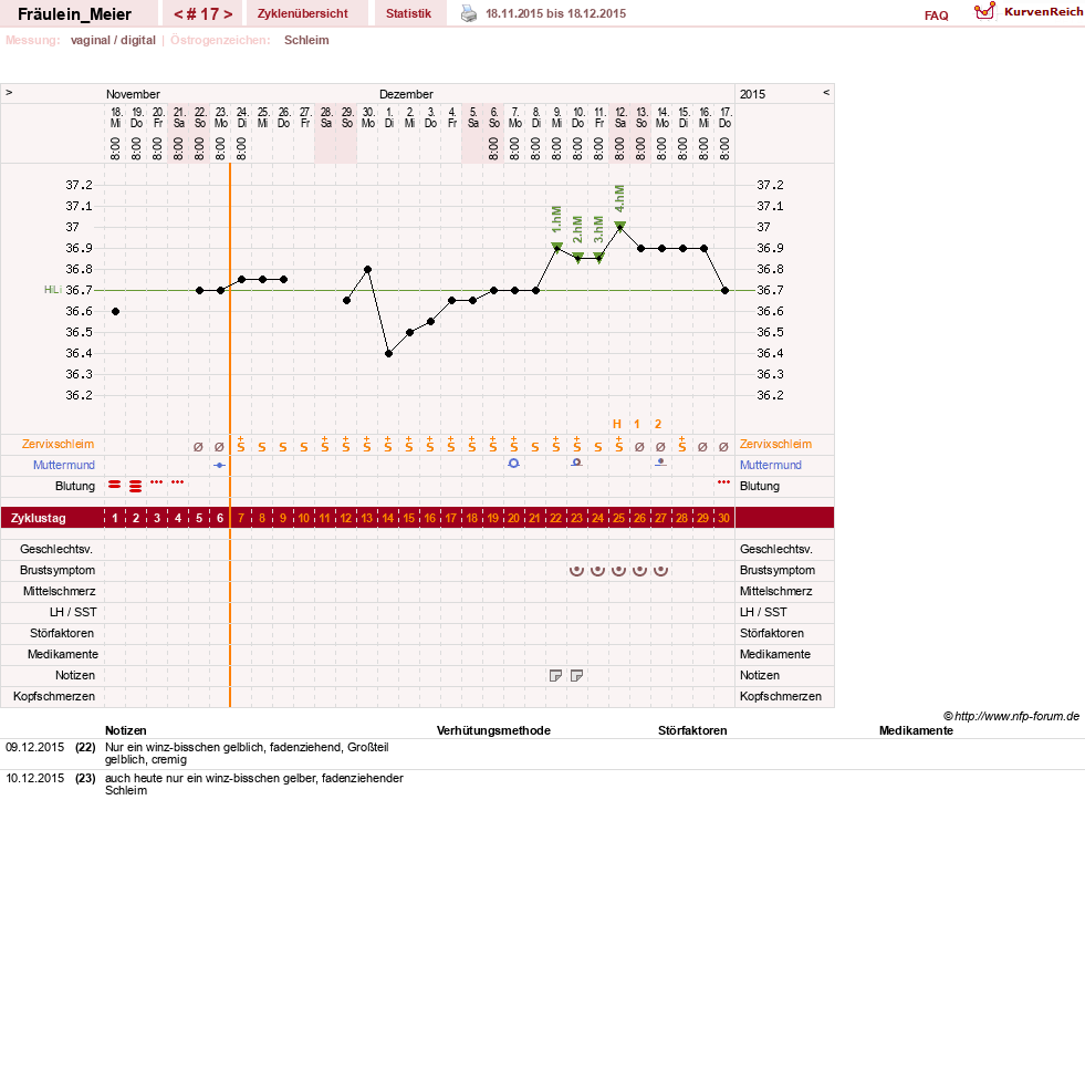 NFP-Kurve User #25664