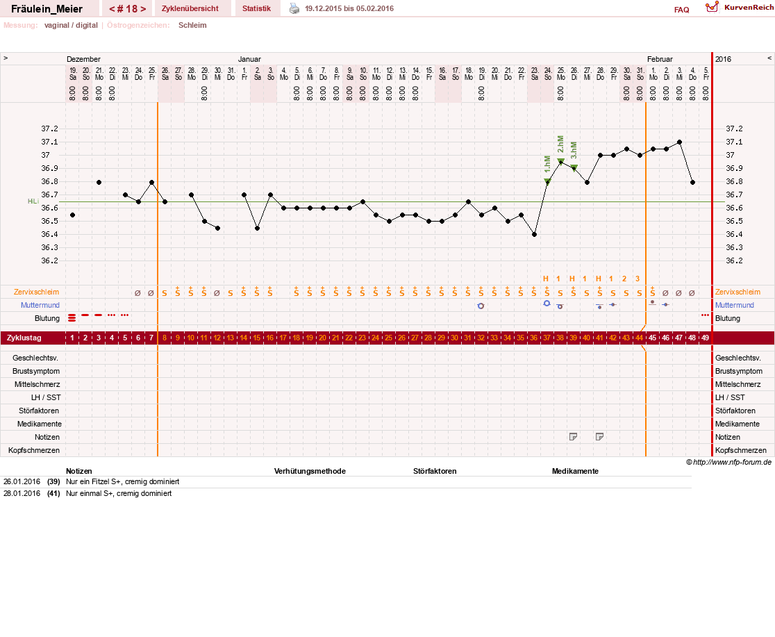 NFP-Kurve User #25664