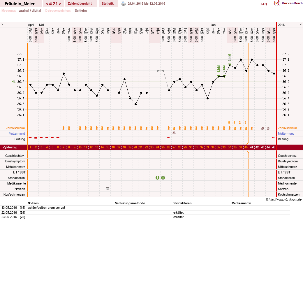 NFP-Kurve User #25664
