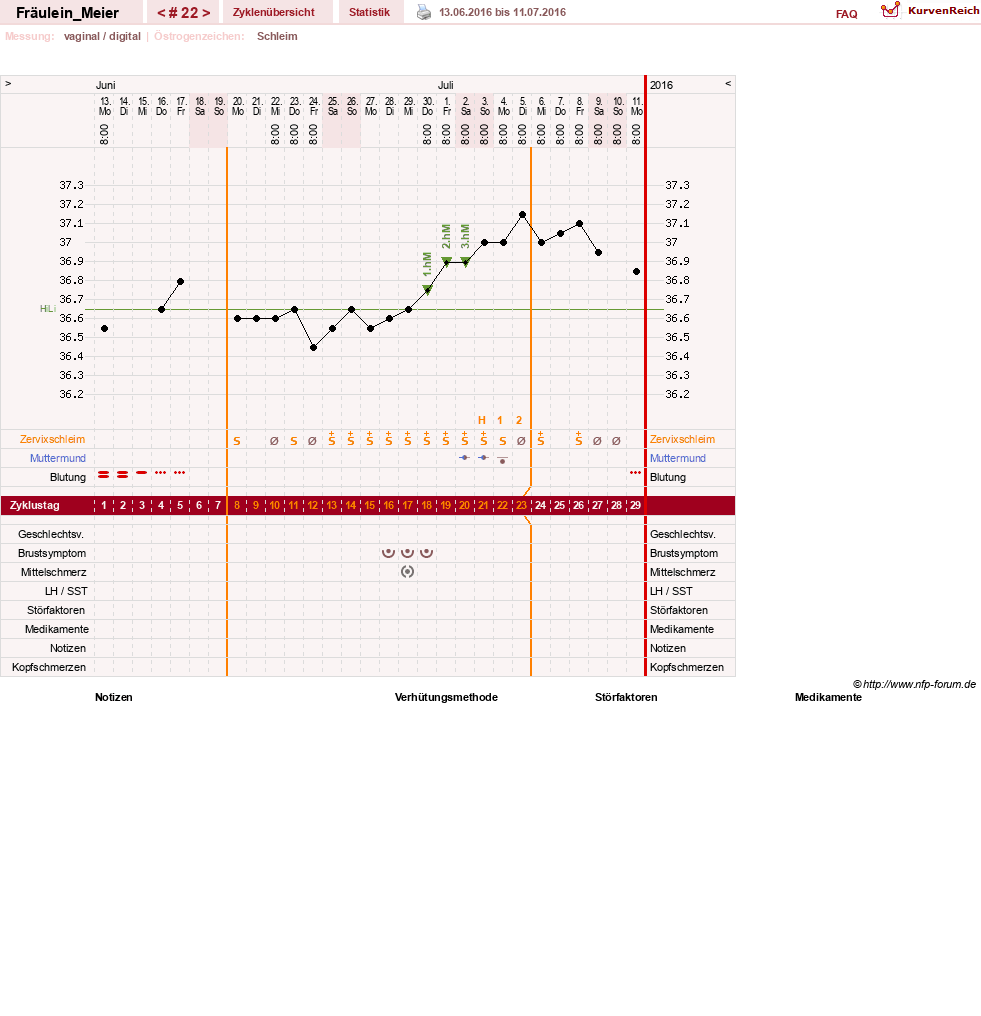 NFP-Kurve User #25664