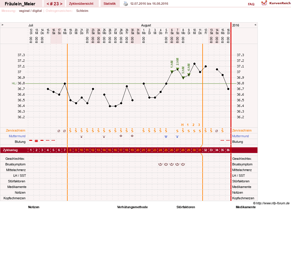 NFP-Kurve User #25664
