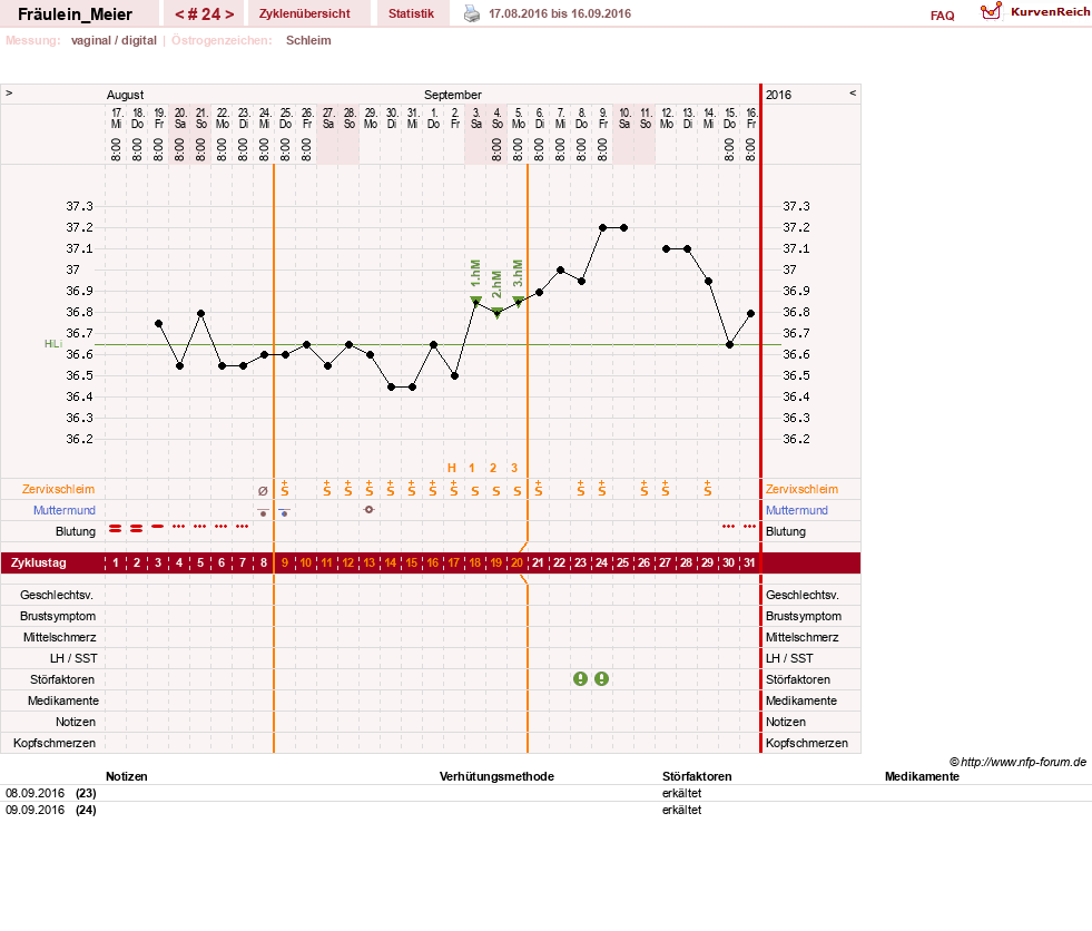 NFP-Kurve User #25664