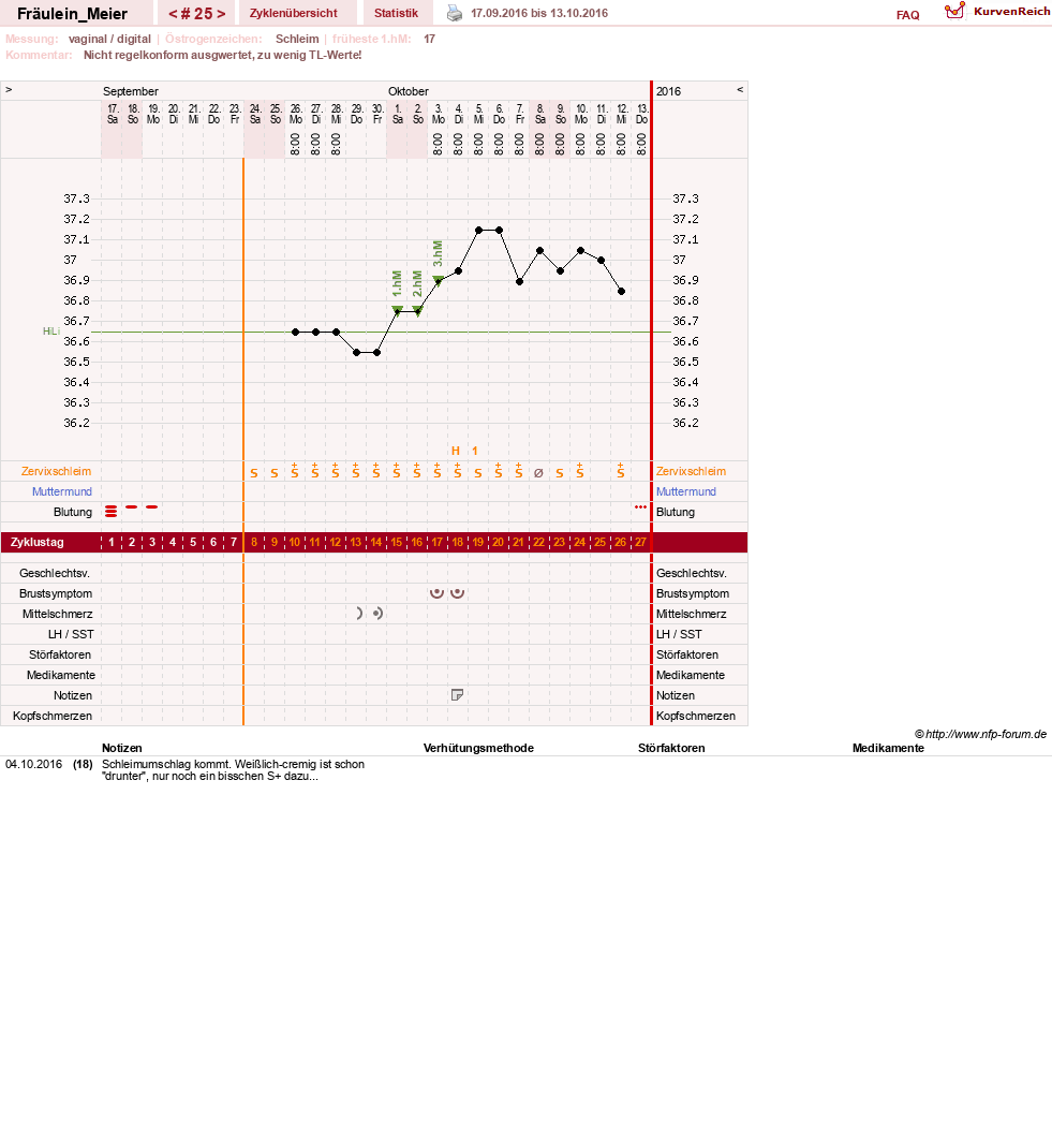 NFP-Kurve User #25664