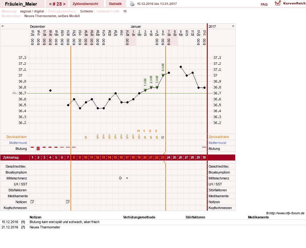 NFP-Kurve User #25664