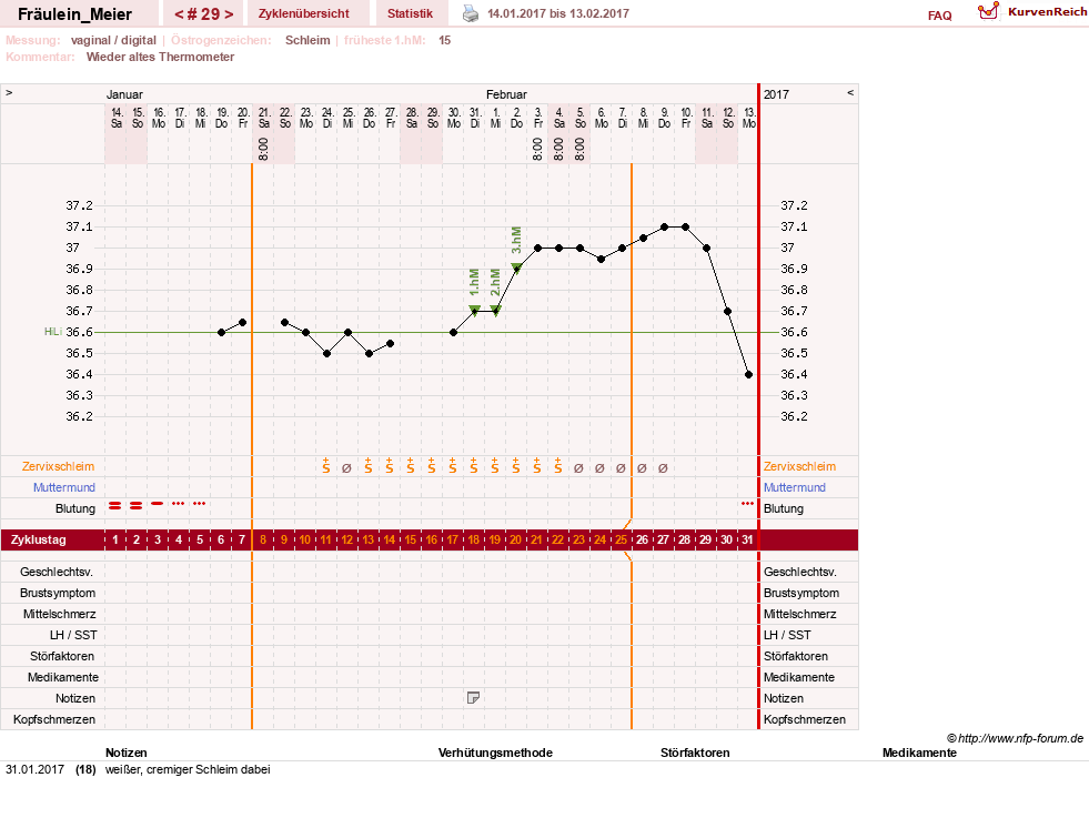NFP-Kurve User #25664