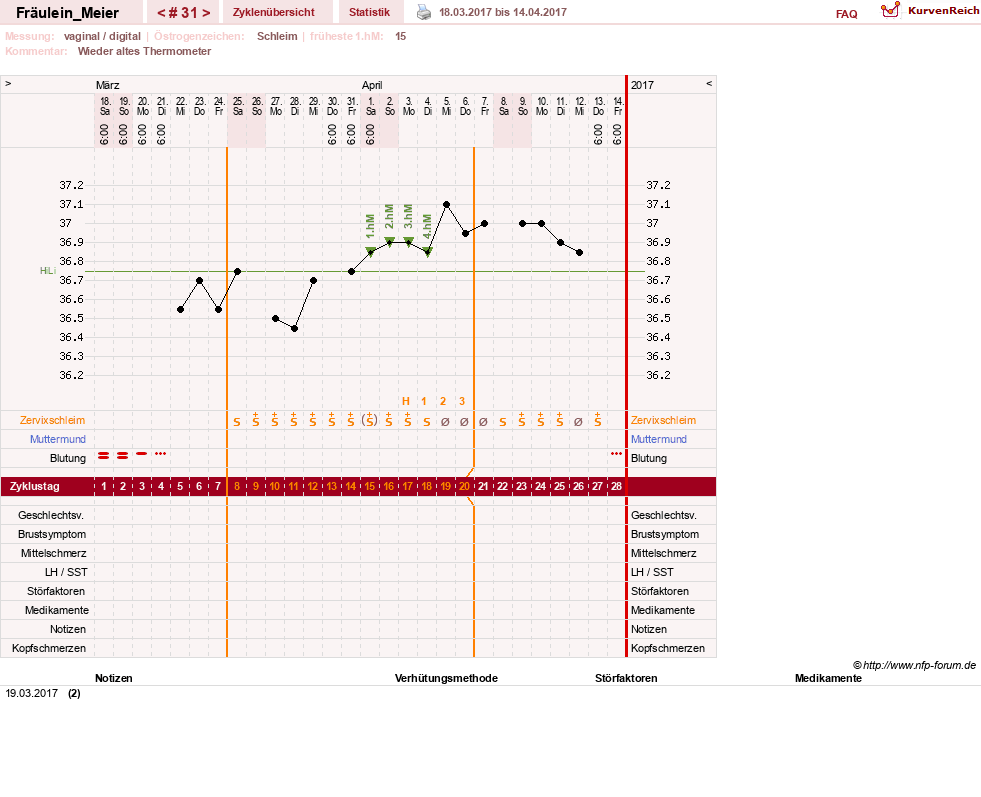 NFP-Kurve User #25664