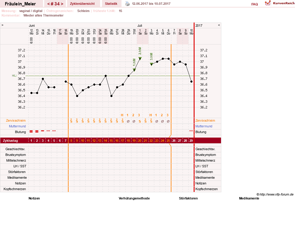 NFP-Kurve User #25664