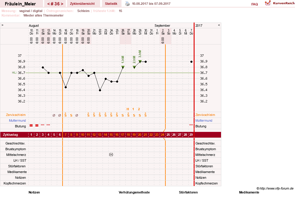 NFP-Kurve User #25664