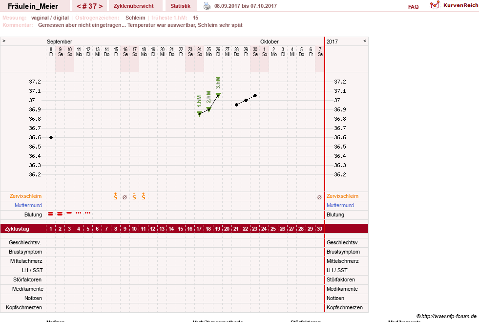 NFP-Kurve User #25664