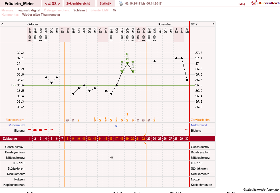 NFP-Kurve User #25664