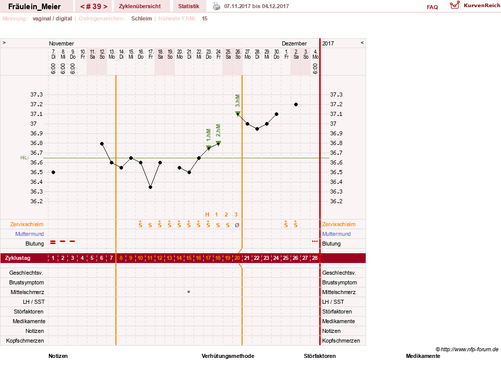 NFP-Kurve User #25664