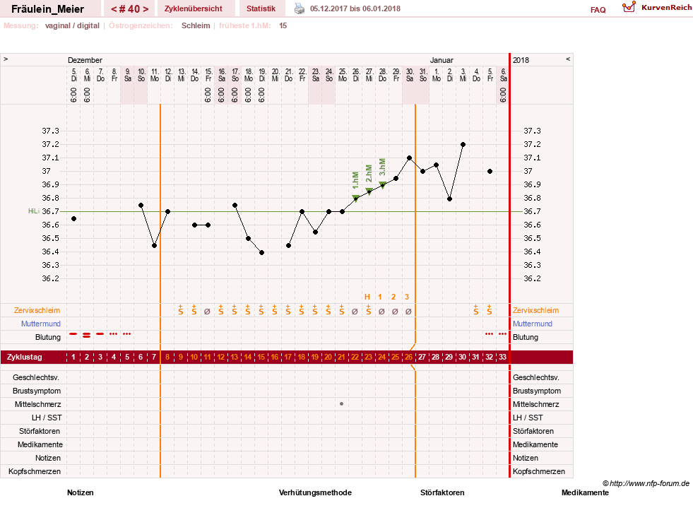 NFP-Kurve User #25664