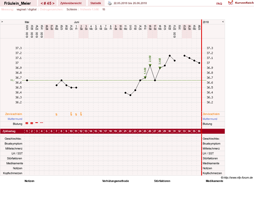 NFP-Kurve User #25664